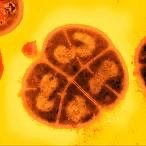 Deinococcus radiodurans for nuclear decontamination