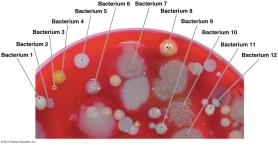 Serological test results
