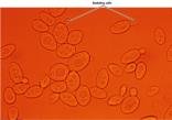 Yeast cells with budding