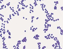 Table comparing Gram-positive and Gram-negative bacteria