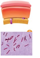 Acid-fast stained Mycobacterium tuberculosis