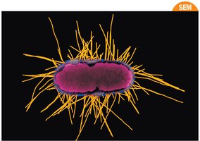 Fimbriae on bacterial cell