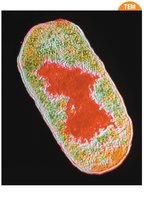 Nucleoid region in prokaryotic cell