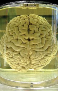 Brain preserved in aldehyde solution