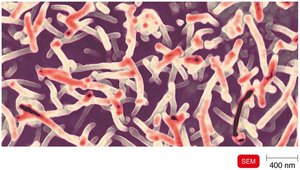 SEM image of Ebola virus