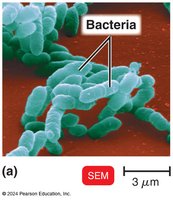 SEM image of bacteria
