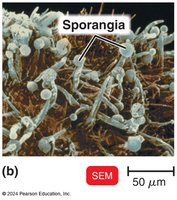 SEM image of fungal sporangia