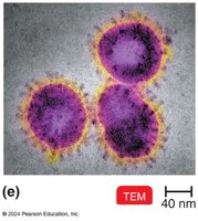 TEM image of viruses