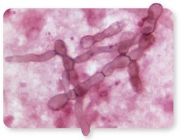 Microscopic image of fungal cells