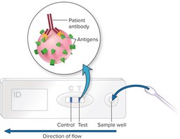 Immunochromatography test diagram
