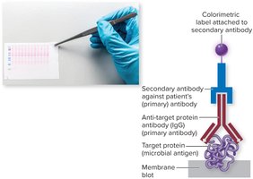 Western blot procedure