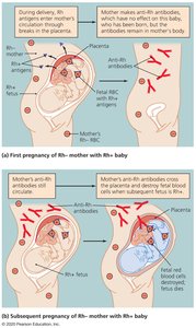 Diagram of Rh incompatibility and hemolytic disease of the newborn