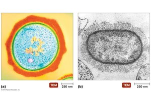 Transmission electron micrographs of bacterial cells with glycocalyx