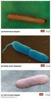 Micrographs of basic arrangements of bacterial flagella