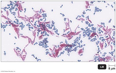 Acid-fast stain results