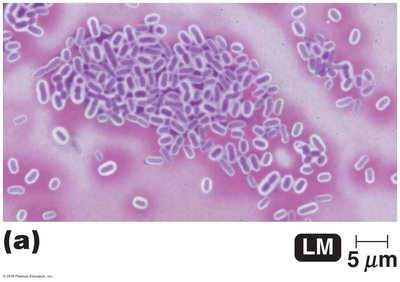 Capsule stain results