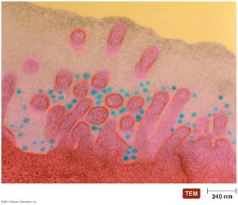 Transmission electron micrograph of rhinoviruses infecting respiratory epithelium