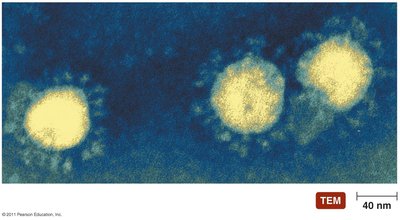 Coronaviruses under TEM