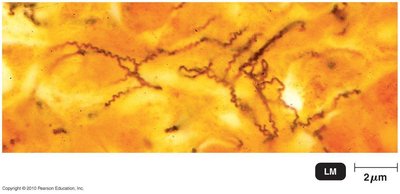 Treponema pallidum spirochetes under light microscopy