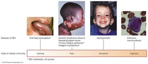 Diseases associated with Epstein-Barr virus