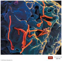 Filamentous Ebolavirus budding from an infected cell