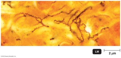 Treponema pallidum, the cause of syphilis