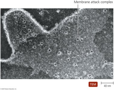 TEM image of membrane attack complex on a cell membrane