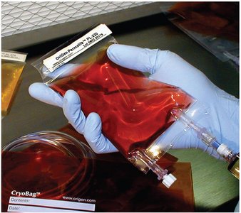 Example of cell culture