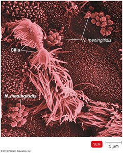 Electron micrograph of Neisseria meningitidis interacting with cilia