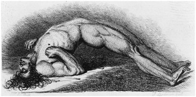 Drawing of tetanic spasm (opisthotonos) in tetanus