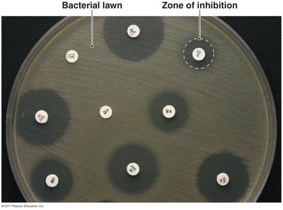 Zone of inhibition in a diffusion susceptibility test