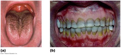 Side effects resulting from toxicity of antimicrobial agents
