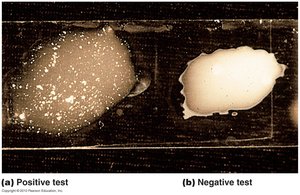 Image showing positive and negative results in a biochemical test
