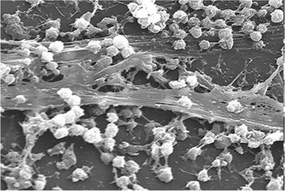 SEM of biofilm structure