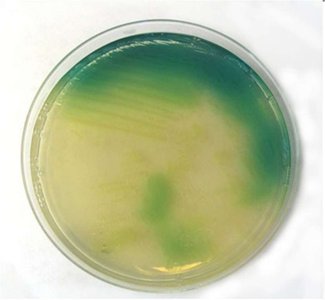 Pseudomonas aeruginosa green pigment on agar
