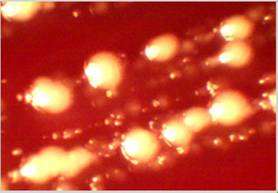 Bacterial colony growth