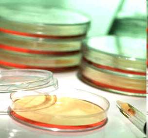 Petri dishes with solid agar media