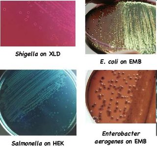 Examples of selective and differential media