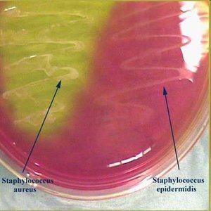Mannitol Salt Agar differentiating Staphylococcus species