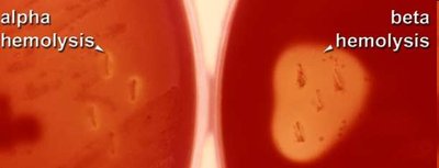 Alpha and beta hemolysis on blood agar (enrichment media)
