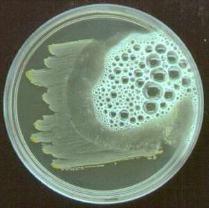 Catalase test on Staphylococcus aureus