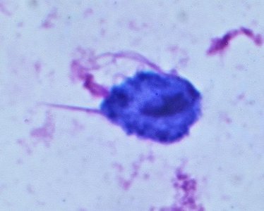 Trichomonas vaginalis, stained specimen