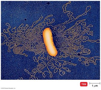 Electron micrograph of a bacterial chromosome