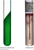 Examples of Simmons citrate and motility test media