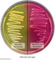 Mannitol salt agar showing fermentation results