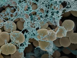 Biofilm structure under microscope