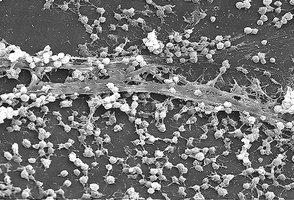 Biofilm formation on a surface