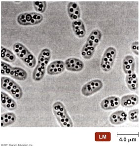Deposits of sulfur within purple sulfur bacteria