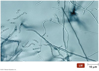 Branching filaments of actinomycetes