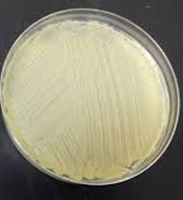 Bacterial lawn on agar plate